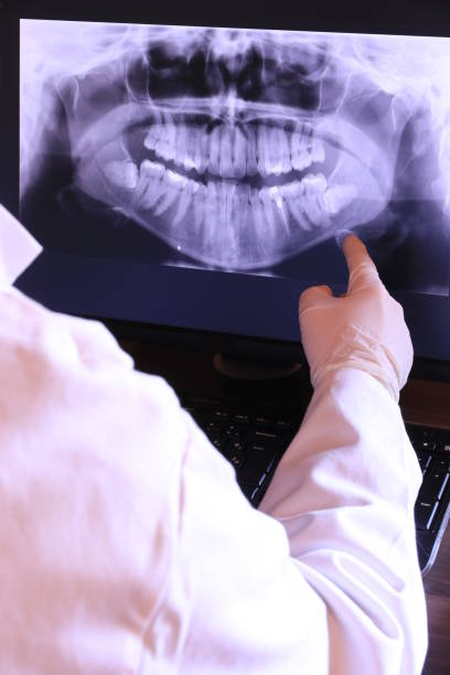Best Emergency Treatment for Dental Infections or Abscesses in Holiday, FL